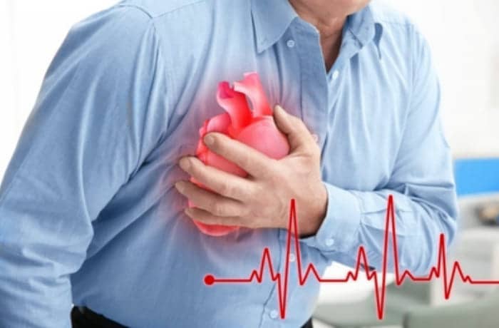 Фактори ризику серцевої недостатності. Інфаркт міокарду